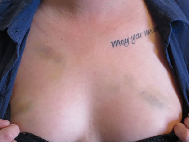 15 hombres agreden brutalmente a un grupo de lesbianas