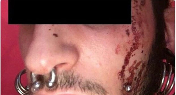 Dos brutales agresiones homófobas en las últimas 24 horas en Barcelona