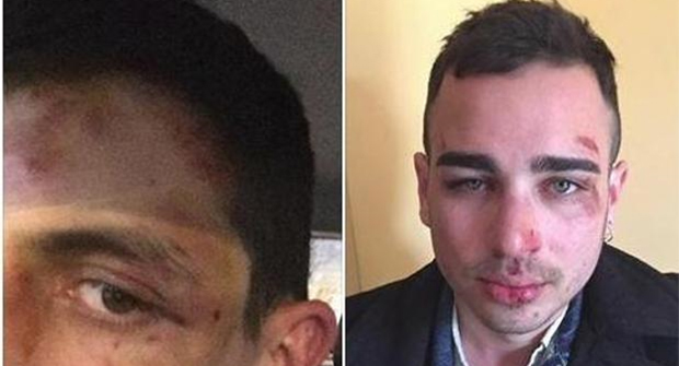 Dos brutales agresiones homófobas en las últimas 24 horas en Barcelona