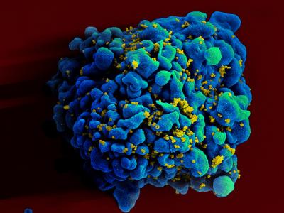 Una inyección mensual: el nuevo tratamiento VIH