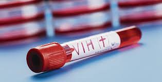 Primera vacuna que controla sin antirretrovirales el VIH