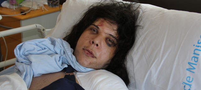 Una mujer transexual recibe una paliza en Málaga