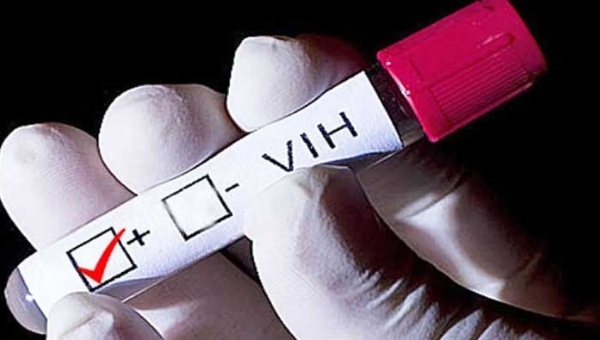 Queman unos muebles para “evitar” contagio de VIH