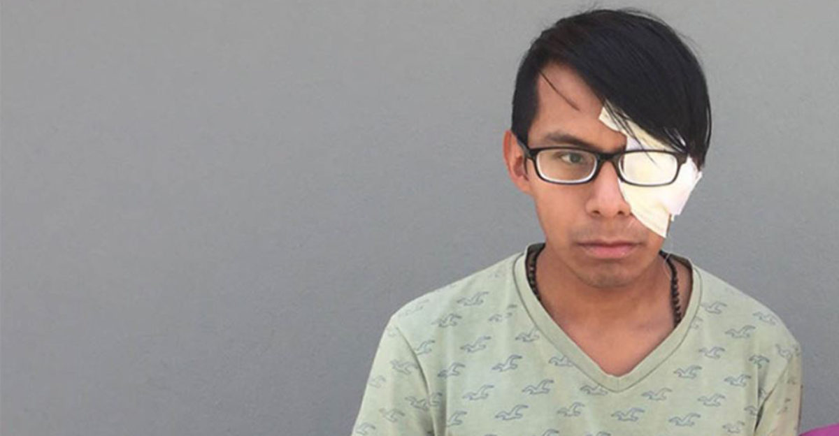 Un joven pierde la visión en un ojo debido a una agresión homófoba