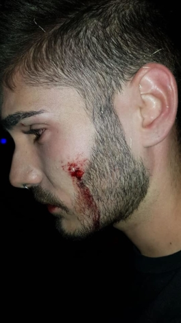 Un joven sufre una agresión homófoba a la salida de una discoteca: "¡Aquí no queremos maricones!"