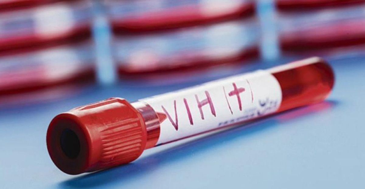 Se confirma la segunda cura de un paciente con VIH