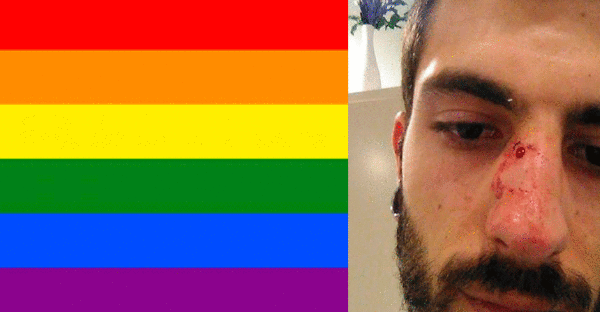 Un joven denuncia en Twitter la agresión homófoba que sufrió