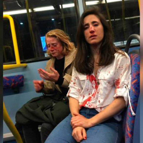 Stop homofobia: Brutal ataque a una pareja de lesbianas en un autobús de Londres