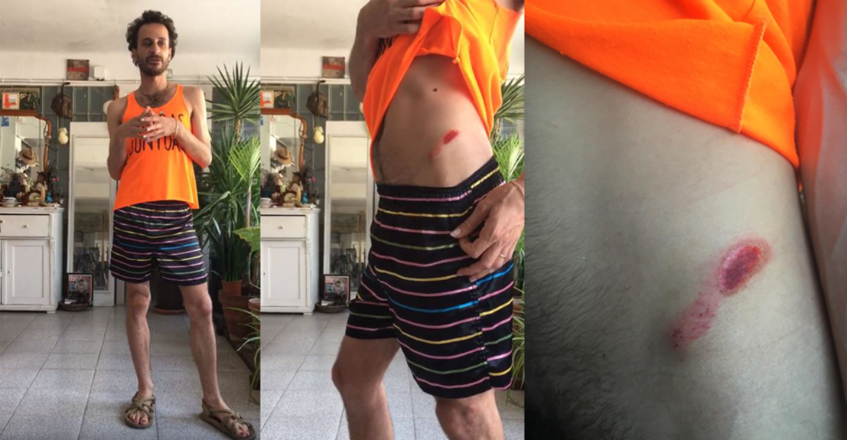 Grave agresión homófoba en Barcelona: "Me atacan por mi pluma"