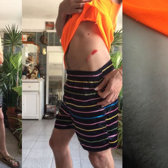 Grave agresión homófoba en Barcelona: "Me atacan por mi pluma"