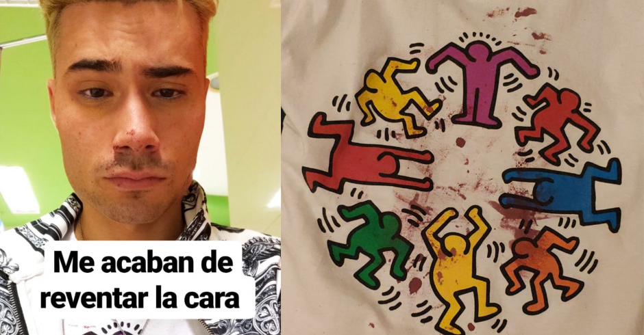 Hablamos con la víctima de una agresión homófoba en Zamora