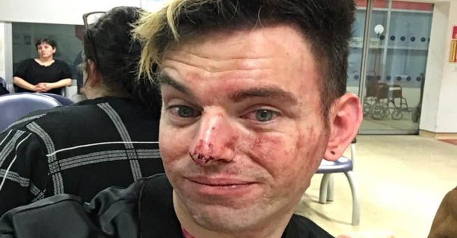 “Maricón, eso no es natural”: agresión homófoba a un hetero por defender a sus amigos gays