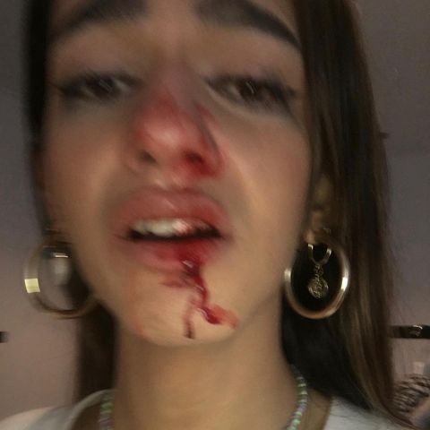 Una joven sufre una brutal agresión tránsfoba en Barcelona al grito de "¡puto travelo!, ¡engendro!"