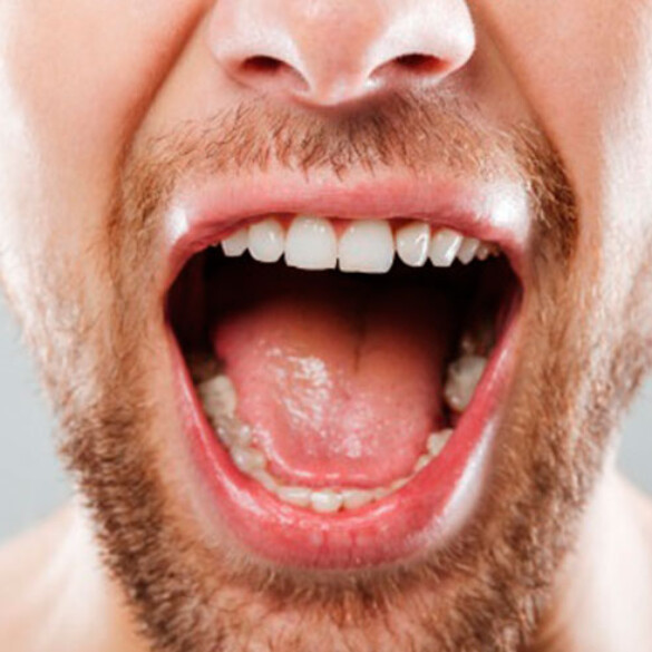 ¿Puede tu dentista saber si has tenido sexo oral solo con mirarte la boca?