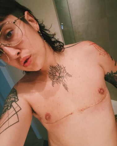 Melo Moreno muestra su cuerpo desnudo un mes después de su mastectomía