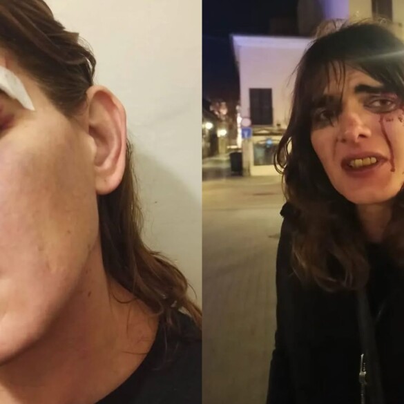 Brutal agresión a una mujer trans en Alcalá de Henares (Madrid): "Lo estaba disfrutando"