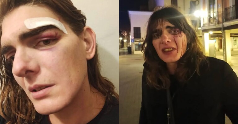 Brutal agresión a una mujer trans en Alcalá de Henares (Madrid): "Lo estaba disfrutando"