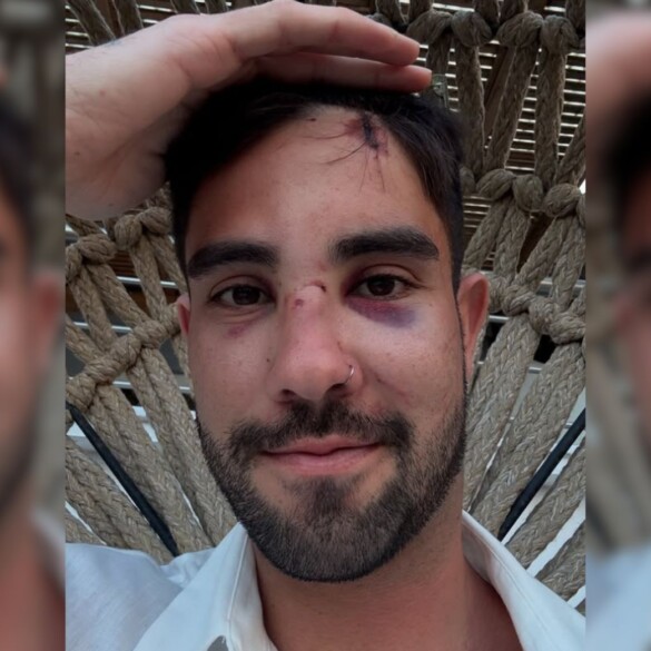 Agresión homófoba en Grecia: "No conseguiréis que nos callemos"