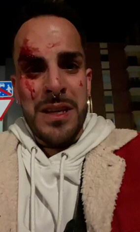 Un finde lleno de homofobia: denuncian varias agresiones y palizas a personas LGTBIQ+ en España