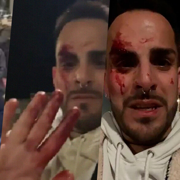 Un finde lleno de homofobia: denuncian varias agresiones y palizas a personas LGTBIQ+ en España