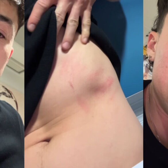 Nueva agresión homófoba en una conocida discoteca de Madrid: "Empezaron a darme puñetazos y patadas"