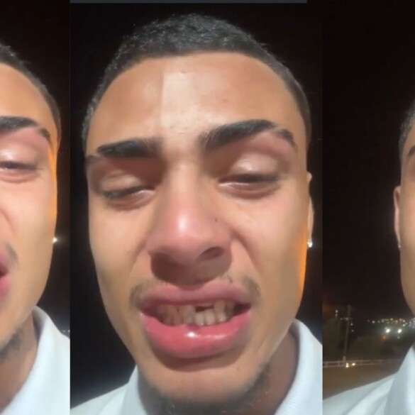 Un chico brasileño se vuelve viral en redes tras sufrir una brutal agresión homófoba