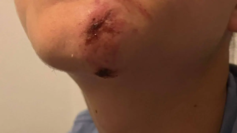 Las heridas de la víctima tras ser golpeado.