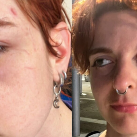 Agresión homófoba en Pontevedra: "Empezaron a gritarme 'bollera de mierda"