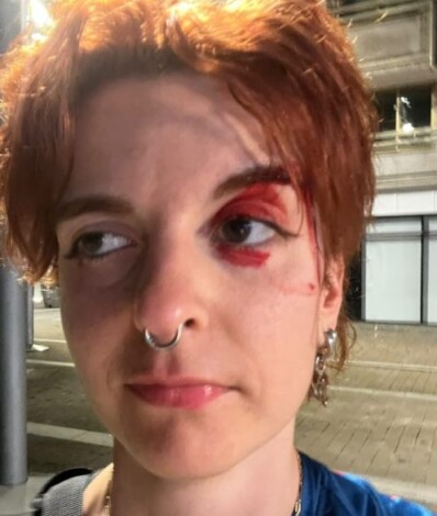 El resultado de los golpes.