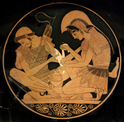 'Aquiles vendando las heridas de Patroclo'.